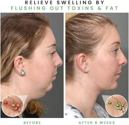 Slimory ultrasonic Lymphatic Soothing Neck Instrument before and after using body shaper