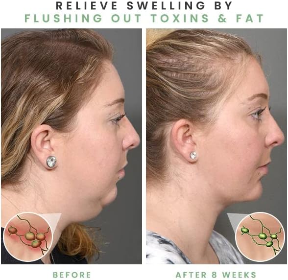 Slimory ultrasonic Lymphatic Soothing Neck Instrument before and after using body shaper