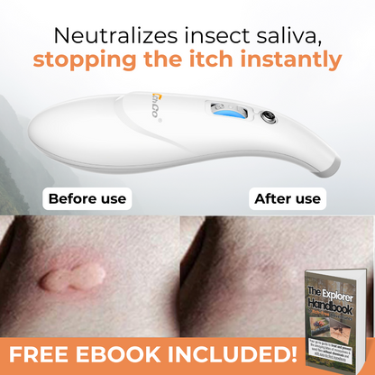 ItchGo – Instant Mosquito & Sandfly Bite Relief